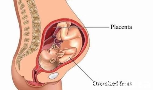 肚皮|胎盘前壁是男孩,后壁是女孩?别说,胎盘的位置还真深藏“玄机” 美妈很帅