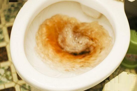 马桶“发臭发黄”,撒一把不值钱的“它”进去,洗完和新的一样!