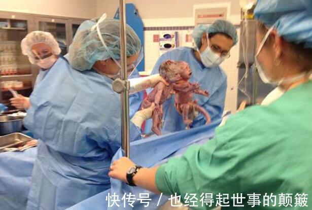 形影不离|双胞胎姐妹花手牵手一起出生,如今2岁了,两个人依旧是形影不离