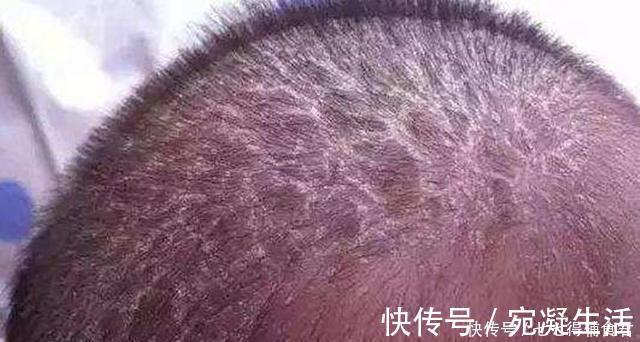 脐带|小婴儿身上这3个部位再脏也不要洗家长要清楚,别洗错了