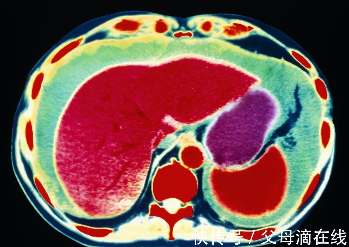 灌注|又一抗癌杀招出现，利于高温“烫死”癌细胞！可以治疗多种癌症