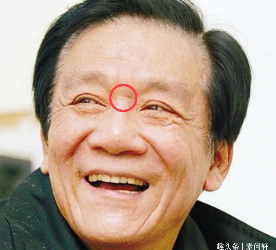 横纹|脸上这个痕迹,竟能1秒检测心脏病!很多人都中招了……