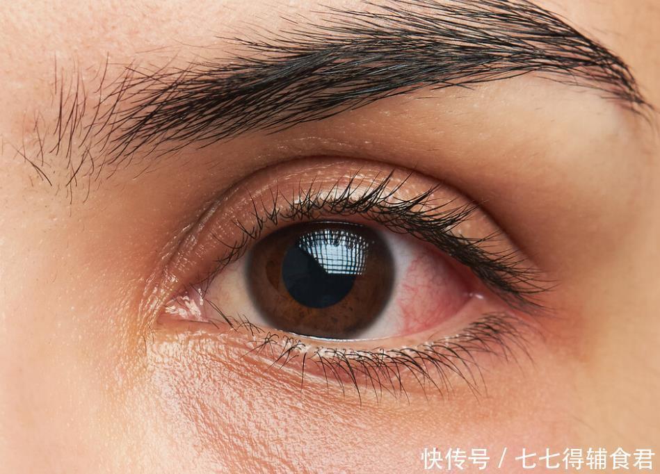 肝脏的“黄金搭档”找到了,不是菊花,平时可劲喝,肝脏越发健康