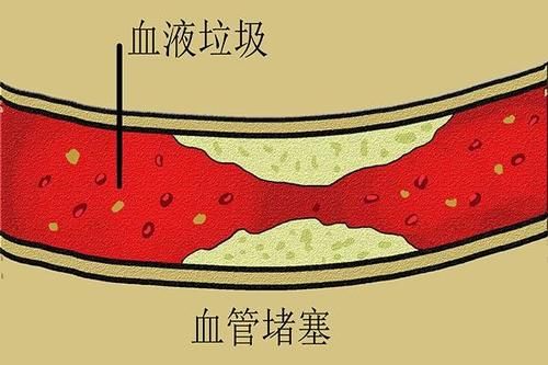 喝红酒能去除血管中的垃圾？真正清扫血管的方法被发现，照着做
