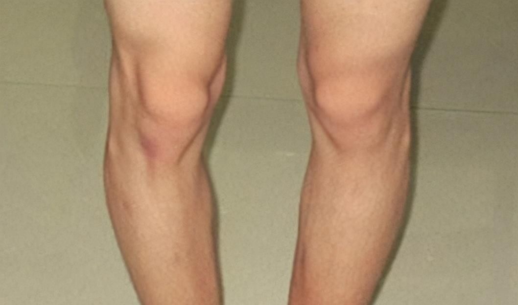 缺钙|“补钙状元”终于被发现，不是牛奶也不是骨头汤，孩子多吃长个快