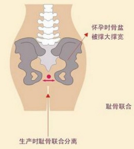骨缝|生孩子开骨缝是咋回事是女人身体的骨头与骨头接缝都打开了吗