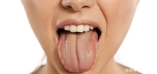 脾脏|脾胃虚弱,身体多半有3种“迹象”,多吃3物,脾胃慢慢变“强壮”