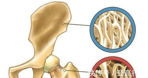 骨质疏松|茄子是骨质疏松的“发物”吗?想要养骨,这4种食物尽量远离