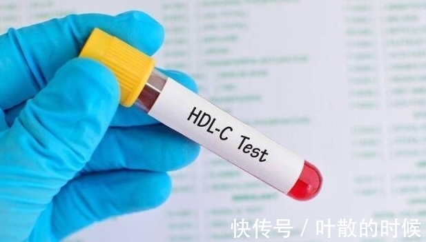 头晕头痛|3种食物是“溶脂高手”，中老年人可多吃，血管或能“平滑如玉”