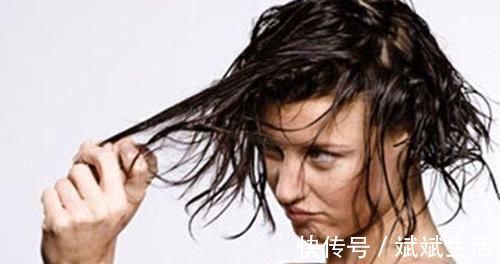 头皮屑|头发,越洗越油,越洗越少?坚持“3不要吃5物”,头发回到年轻时