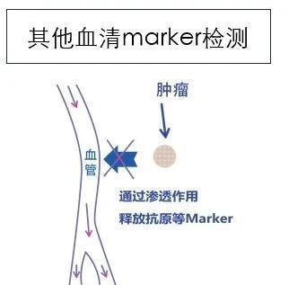 有肺结节的人,都值得看一看