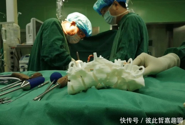 “痛苦”手术排行榜，四个之中经历一个，你可能也是很坚强的