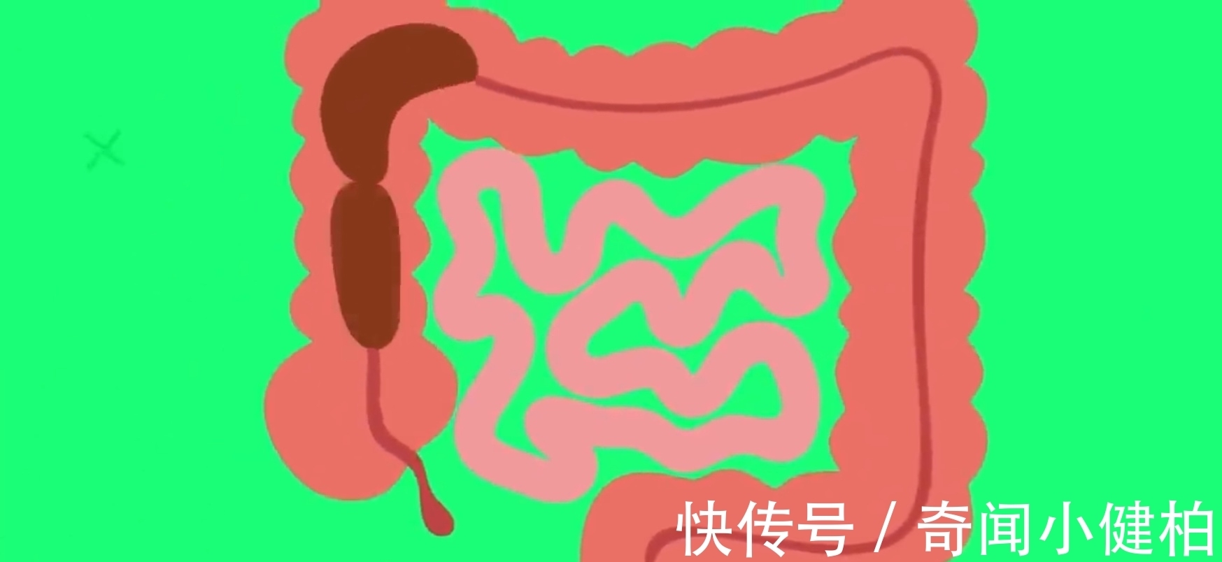 大便|大便反映健康秘密?不看别后悔