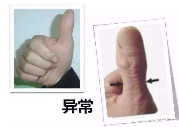 戒烟|肺不好,鼻先知,远离“3个字”,做好5件事,肺会一天比一天强壮