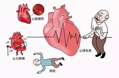 龙云|中年男子急性心梗命悬一线，医生提醒以下征兆要当心