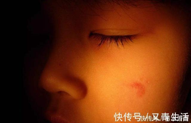 孕期|为什么有的宝宝会有“胎记”产科医生孕期要避免这3种行为