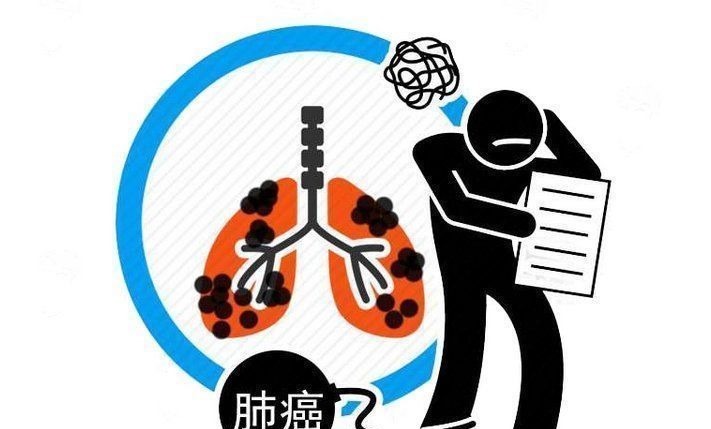 肺脏|肺癌是拖出来的！医生忠告，每天早晚做好4件事，肺会更好