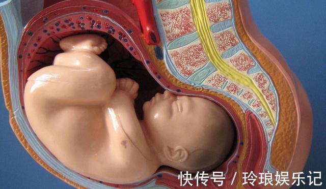 后悔药|妻子顺产不下来,丈夫拒绝剖宫产,结果妻子孩子没有保住