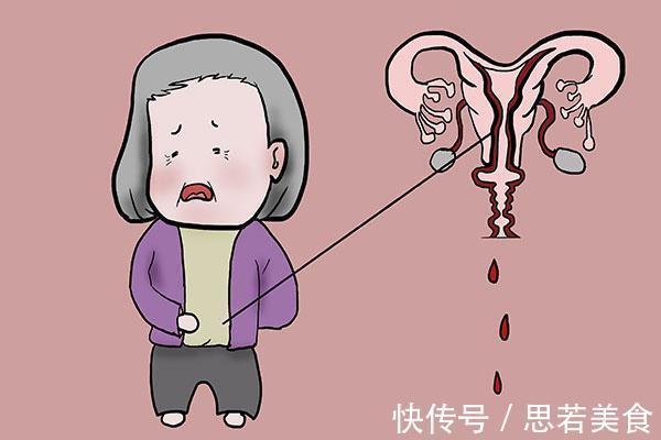 子宫|女性若有子宫肌瘤,身体会有4个明显变化,如果发现须尽早处理
