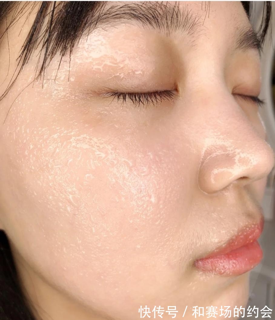 精华 为什么你的皮肤越护理越糙可能踩了这5个护肤误区,你中了几个