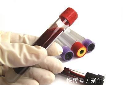 血糖|餐前血糖4.5正常吗？他却因此而被诊出糖尿病，诊断标准是多少？