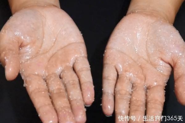 白糖倒在手上搓一搓，用途真是太厉害了，解决很多人困扰的烦恼！