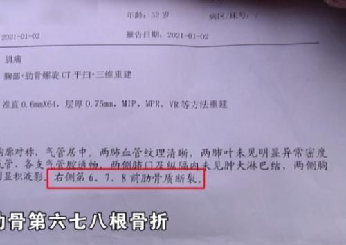 生完孩子胸部疼，男子称妻子太娇气，检查后发现断了三根肋骨