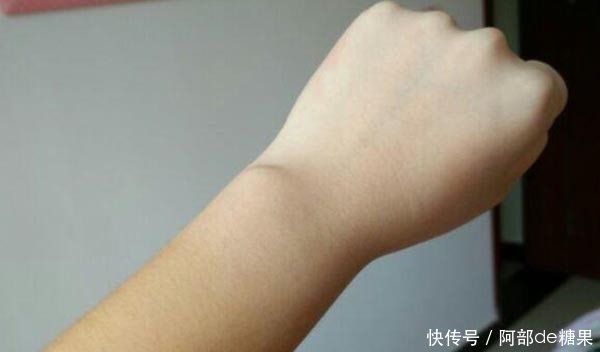 为何有些女性体毛多,有些女性体毛少?体毛过于旺盛,能刮吗?