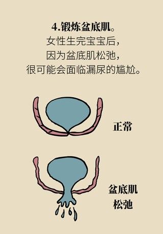 盆底|有效预防痔疮、按摩前列腺、锻炼盆底肌......这项运动虽小,好处不少