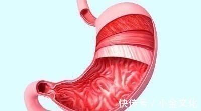 修复|胃炎怎么办,多吃“4宝”,修复胃黏膜,现在知道还来得及