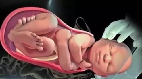 宫缩|卸货前,这些知识医生不会提前告诉你,孕妈提早知,击穿分娩障碍