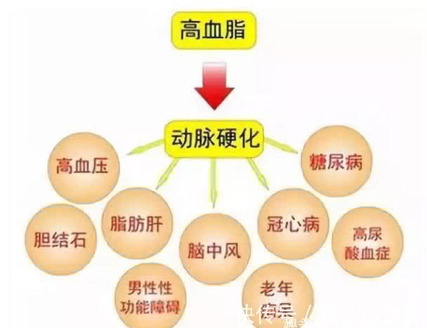 高血脂症|高血脂源头并非大鱼大肉吗？可能是一酸，医生建议：尽量少吃