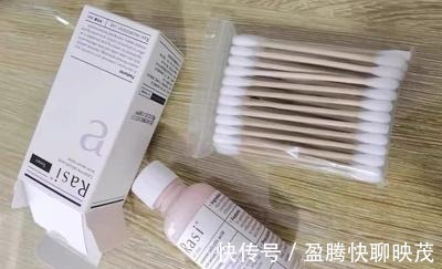 痘痘|天气越热、“痘痘”越多?3个原因+改善方法,瑕疵痘痘肌有救了