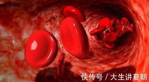 回事|血常规检查，这3个指标别不当回事，身边小事或与健康息息相关