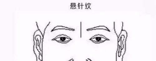  发现|有没有冠心病？一手一脸就能辨！中医教你发现端倪，3招去除病根