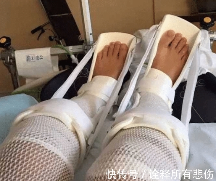 李亚诺|7年前,李亚诺花16万锯断骨头,只为长高7厘米,手术后怎样了?