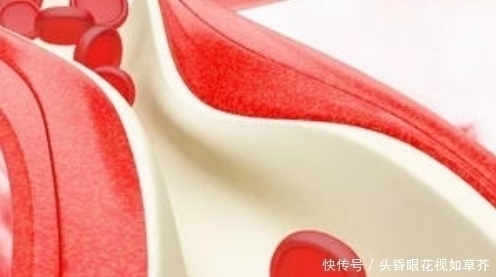 心脑血管疾病|血栓天敌被发现了,每天吃2口,清血管冲走血栓,杜绝高血脂