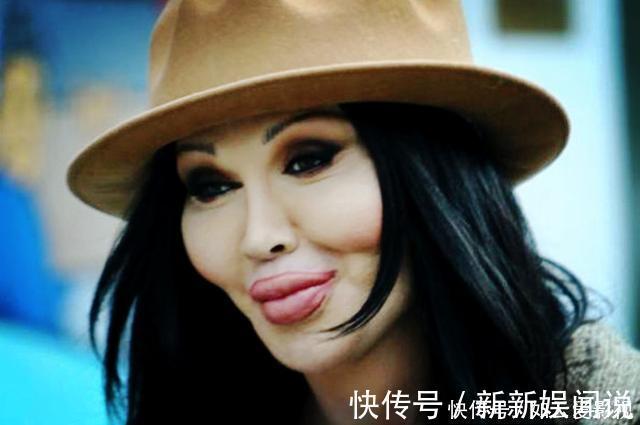 孙菲菲|那些整容的人最后都怎么样了?人生的周期,远比玻尿酸要长