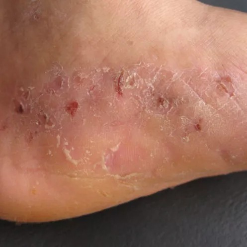 西宁人流的选择:专业与温馨同行