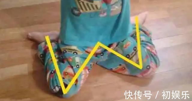 一肩|8岁男孩脊椎侧弯,只因家人常做这个动作,这个错误,90%的父母都在犯