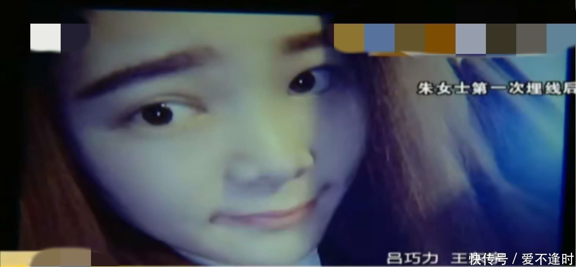 女子做双眼皮手术,术后一直红肿,美容院:我们负责!