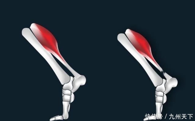 告诉|武侠小说中挑断手筋和脚筋是怎么回事?还有救吗?医生告诉你答案