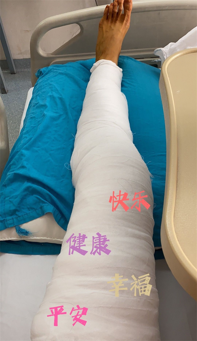 宫美子|张常宁手术成功!1米2大长腿裹满绷带,大脚丫至少穿46码鞋子