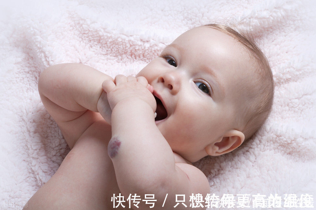 今日头条|血管瘤是怎么回事?需要治疗吗?医生:要根据情况而定