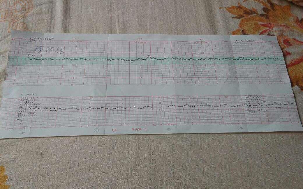 好孕|怀“小王子”的宝妈，身上有这4大特征，赶快接好孕吧