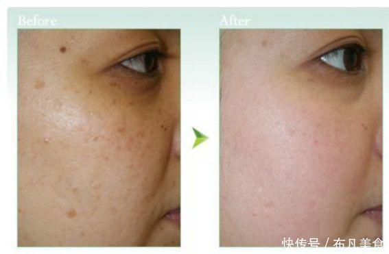 这些医美项目比你们所有的化妆品还有用！
