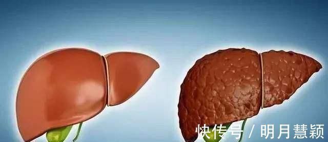 养肝护肝|肝病“最怕”1水,平时可劲喝,不出1个月,肝会“感激”你
