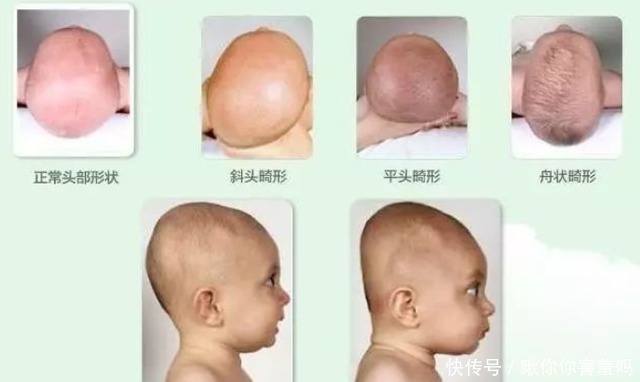 中国人|为什么中国老人喜欢给孩子睡扁头?长大后才发现,真的影响颜值