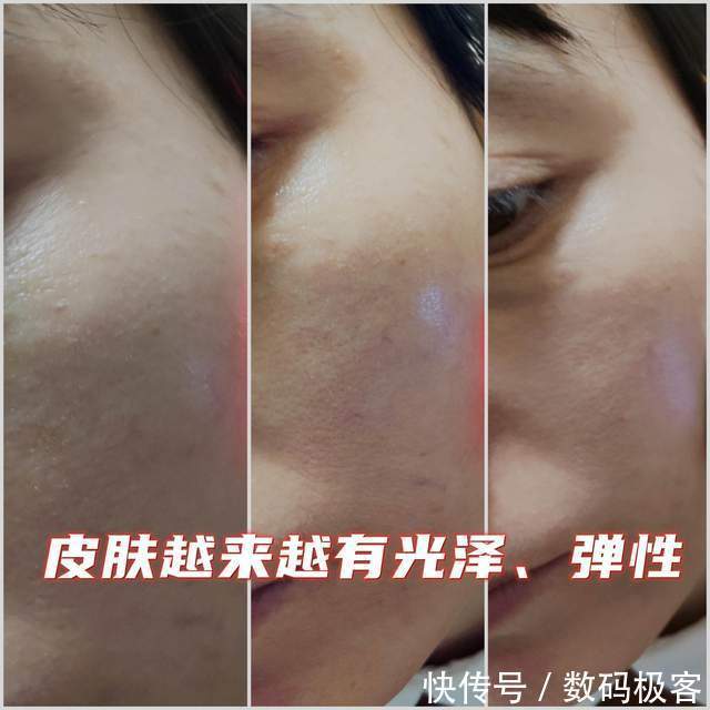 美容仪|唤醒肌肤 重现青春 Notime射频美容仪入手体验