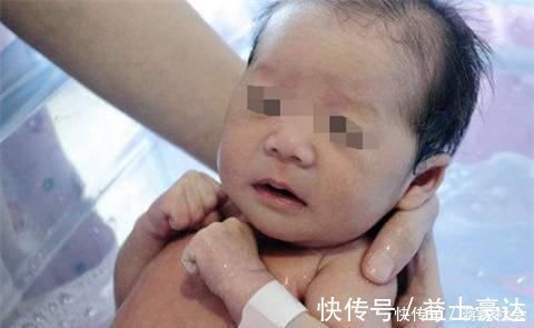 女子|27岁女子生孩子用力过猛出现这异状,切记分娩时一定要注意这三点